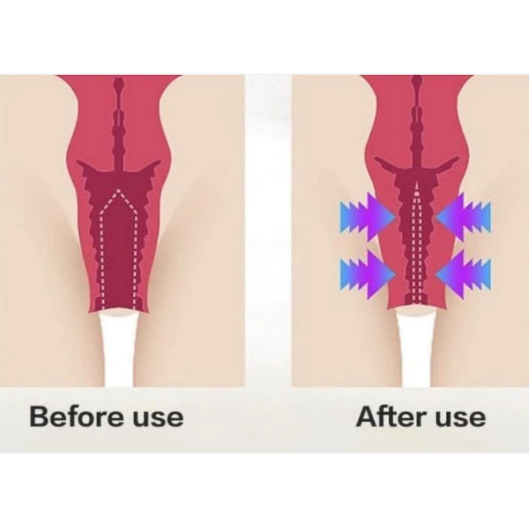 Snapback V-Tightening Gel